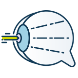 An icon of an eye with an arrow in it designed for Eye care professionals.