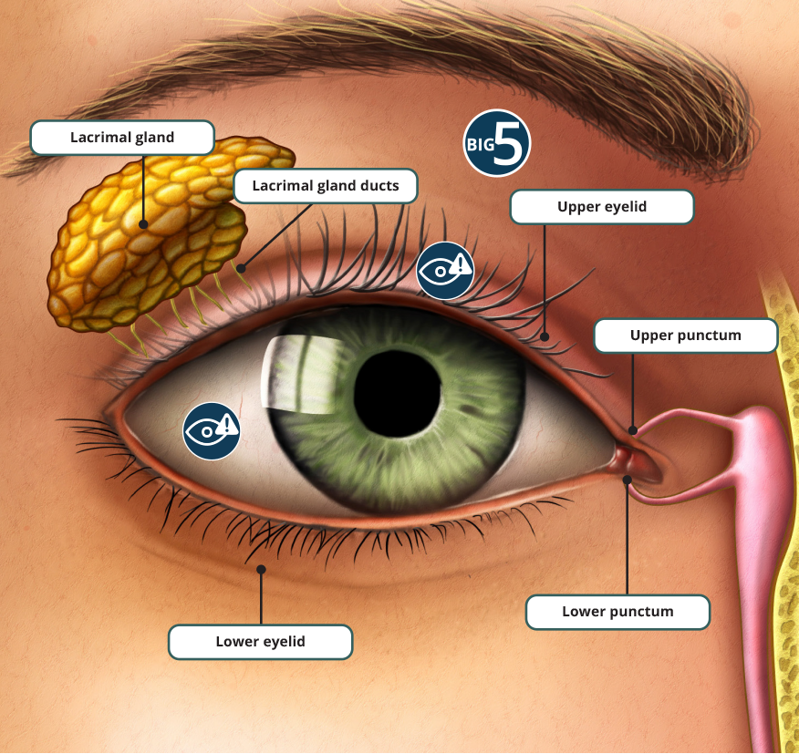 Around the Eye